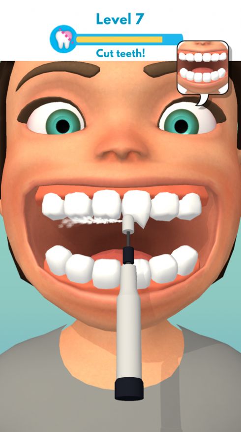 ϴʦϷֻأPerfect Teeth  v1.0.1 screenshot 2