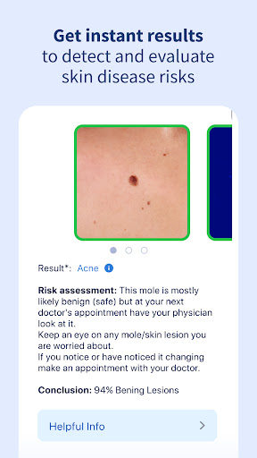 AI Dermatologist Skin Scanner mod apk premium unlockedͼƬ1